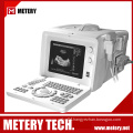 Ultrasound diagnosis scanner MT300V series